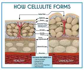 with How to Cellulite Shop - Using Away Roller Treatment? Derma Dermarolling Do
