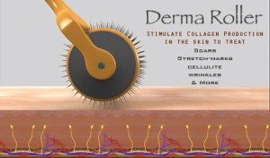 Dermarolling for anti-cellulite treatment – Is this a new way to get your  bikini body without work-out? - Derma Roller Shop